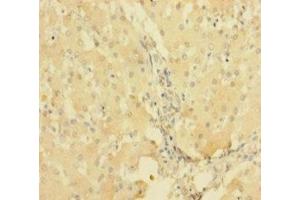Immunohistochemistry of paraffin-embedded human liver tissue using ABIN7167514 at dilution of 1:100 (PTPRR antibody  (AA 1-412))