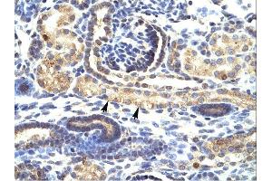 SNAI1 antibody was used for immunohistochemistry at a concentration of 4-8 ug/ml. (SNAIL antibody  (N-Term))