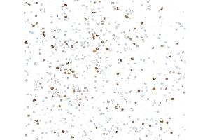 Immunocytochemistry (ICC) image for anti-Forkhead Box M1 (FOXM1) (AA 650-700) antibody (ABIN7795806) (Recombinant FOXM1 antibody  (AA 650-700))