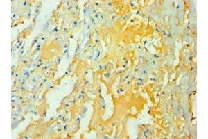 Immunohistochemistry of paraffin-embedded human lung tissue using ABIN7166295 at dilution of 1:100