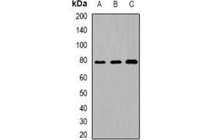 Western blot analysis of DACH1 expression in mouse lung (A), mouse heart (B), rat kidney (C) whole cell lysates.