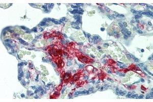 Detection of FE in Human Placenta Tissue using Polyclonal Antibody to Ferritin (FE) (Ferritin antibody)
