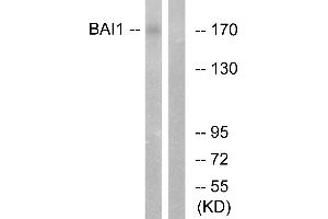 Immunohistochemistry analysis of paraffin-embedded human brain tissue using BAI1 antibody. (BAI1 antibody  (Internal Region))