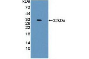 Detection of Recombinant PLEC, Human using Polyclonal Antibody to Plectin (PLEC) (PLEC antibody  (AA 175-400))