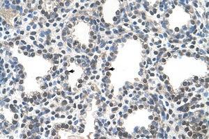 Image no. 1 for anti-Cyclophilin B (PPIB) (C-Term) antibody (ABIN205043) (PPIB antibody  (C-Term))