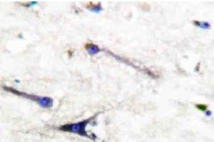 Image no. 1 for anti-Ezrin (EZR) antibody (ABIN265410) (Ezrin antibody)