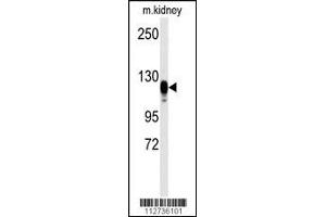 Western blot analysis of anti-EGFR Antibody (S1070) in kidney heart tissue lysates (35ug/lane) (EGF antibody  (AA 1048-1077))