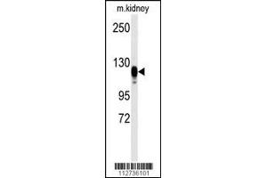 Western blot analysis of anti-EGFR Antibody (S1070) in kidney heart tissue lysates (35ug/lane)