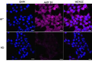 anti-Aldo-Keto Reductase Family 1, Member B1 (Aldose Reductase) (AKR1B1) antibody