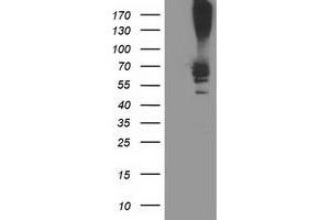 Western Blotting (WB) image for anti-Ribophorin 1 (RPN1) antibody (ABIN1500754) (RPN1 antibody)