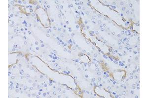 Immunohistochemistry of paraffin-embedded mouse kidney using AQP4 antibody (ABIN6290071) at dilution of 1:50 (40x lens).