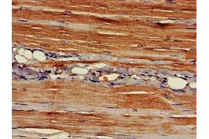 IHC image of ABIN7150938 diluted at 1:400 and staining in paraffin-embedded human skeletal muscle tissue performed on a Leica BondTM system.