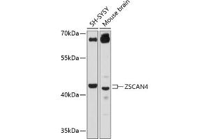 Western blot analysis of extracts of various cell lines, using ZSC antibody (ABIN6133026, ABIN6150544, ABIN6150546 and ABIN6215572) at 1:3000 dilution. (ZSCAN4 antibody  (AA 1-310))