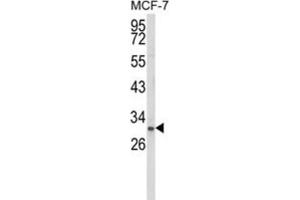 Western Blotting (WB) image for anti-NK3 Homeobox 1 (NKX3-1) antibody (ABIN3003998) (NKX3-1 antibody)