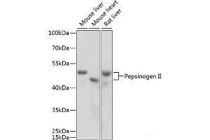 Western blot analysis of extracts of various cell lines using Pepsinogen II Polyclonal Antibody at dilution of 1:1000.