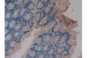 Detection of CXCL16 in Mouse Intestine Tissue using Polyclonal Antibody to Chemokine C-X-C-Motif Ligand 16 (CXCL16) (CXCL16 antibody  (AA 31-241))