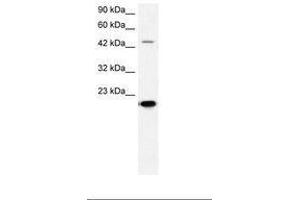 Image no. 2 for anti-Matrix Metallopeptidase 19 (MMP19) (AA 349-398) antibody (ABIN202685) (MMP19 antibody  (AA 349-398))