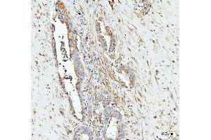 IHC analysis of Grp75 using anti-Grp75 antibody (ABIN7602782). (HSPA9 antibody  (C-Term))