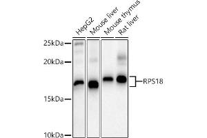 Western blot analysis of extracts of various cell lines, using RPS18 antibody (ABIN6128660, ABIN6147205, ABIN6147206 and ABIN6215379) at 1:1000 dilution.