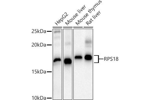 RPS18 anticorps  (AA 1-152)