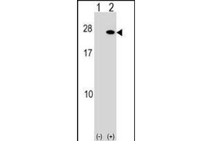 Western blot analysis of FGF19 (arrow) using rabbit polyclonal FGF19 Antibody (C-term) (ABIN1536785 and ABIN2849728). (FGF19 antibody  (C-Term))