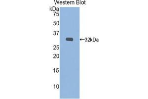 Western blot analysis of the recombinant protein. (IDS antibody  (AA 180-448))