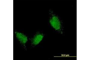 Image no. 1 for anti-Titin (TTN) (AA 1-111) antibody (ABIN598990) (Titin antibody  (AA 1-111))