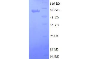 SDS-PAGE (SDS) image for Secreted Protein, Acidic, Cysteine-Rich (Osteonectin) (SPARC) (AA 18-303) protein (GST tag) (ABIN5712686) (SPARC Protein (AA 18-303) (GST tag))