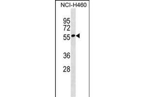 ZN Antibody (N-term) (ABIN1539437 and ABIN2849988) western blot analysis in NCI- cell line lysates (35 μg/lane).