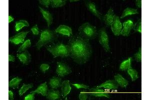 Immunofluorescence of monoclonal antibody to MAPK13 on HeLa cell. (MAPK13 antibody  (AA 1-365))