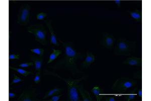 Immunofluorescence of monoclonal antibody to LCAT on HeLa cell. (LCAT antibody  (AA 98-197))