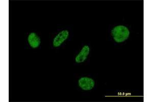 Immunofluorescence of purified MaxPab antibody to BAP1 on HeLa cell. (BAP1 antibody  (AA 1-729))