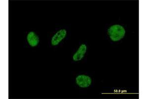 Immunofluorescence of purified MaxPab antibody to BAP1 on HeLa cell.