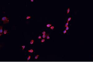 ABIN6266609 staining HEK 293 cells by IF/ICC. (CDKN2B antibody  (Internal Region))