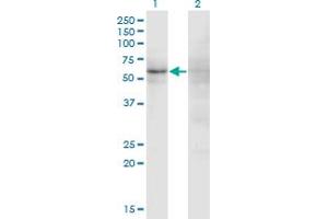 Western Blot analysis of ZNF180 expression in transfected 293T cell line by ZNF180 monoclonal antibody (M01), clone 4F3. (ZNF180 antibody  (AA 176-285))