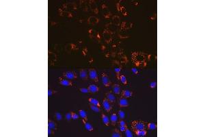 Immunofluorescence analysis of NIH-3T3 cells using SOD2 antibody (ABIN7270638). (SOD2 antibody)