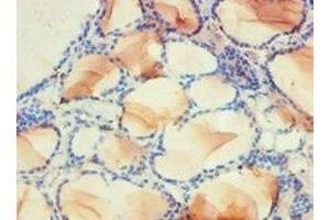 Immunohistochemistry of paraffin-embedded human thyroid tissue using ABIN7142339 at dilution of 1:100 (PDPK1 antibody  (AA 277-556))