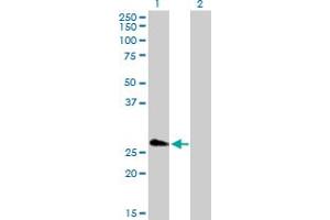 Western Blot analysis of FHL5 expression in transfected 293T cell line by FHL5 MaxPab polyclonal antibody. (FHL5 antibody  (AA 1-284))