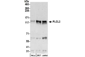 anti-phospholipase C-Like 2 (PLCL2) (AA 1077-1127) antibody