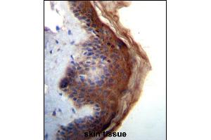 IL1F5 Antibody (N-term) (ABIN656238 and ABIN2845554) immunohistochemistry analysis in formalin fixed and paraffin embedded human skin tissue followed by peroxidase conjugation of the secondary antibody and DAB staining. (FIL1d antibody  (N-Term))