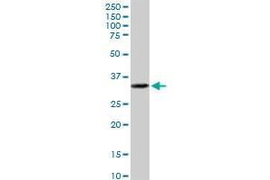 EPCAM MaxPab polyclonal antibody. (EpCAM antibody  (AA 1-314))