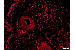 Formalin-fixed and paraffin embedded rabbit meniscus tissue labeled Anti-Collagen II Polyclonal Antibody, Unconjugated  at 1:200, followed by conjugation to the secondary Goat Anti-Rabbit IgG, Cy3 conjugated -Cy3)used at 1:200 dilution for 40 minutes at 37°C. (COL2 antibody  (AA 1201-1300))