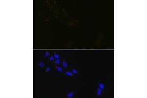 Immunofluorescence analysis of U-2 OS cells using GR Rabbit mAb (ABIN1679751, ABIN3015980, ABIN3015981 and ABIN7101472) at dilution of 1:100 (40x lens). (GORASP1 antibody)