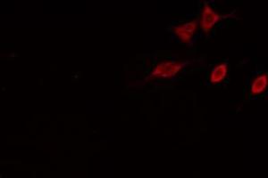ABIN6274837 staining HeLa cells by IF/ICC.