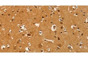 Immunohistochemistry of paraffin-embedded Human brain tissue using PFKFB1 Polyclonal Antibody at dilution 1:60 (PFKFB1 antibody)