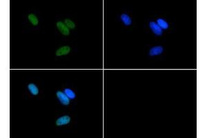 Immunofluorescence of Rabbit Anti-Histone H3 [Asym-dimethyl Arg17] Antibody. (Histone 3 antibody  (H3R17me2a))