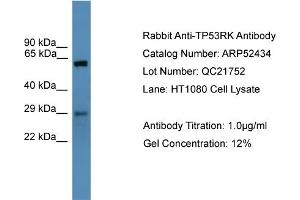 WB Suggested Anti-TP53RK  Antibody Titration: 0. (TP53RK antibody  (N-Term))