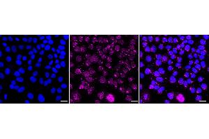 Immunocytochemical staining of HepG2 cells with HRAS antibody (ABIN7799002), 1:1,000). (Recombinant HRAS antibody)