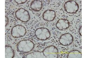 Image no. 1 for anti-Tousled-Like Kinase 2 (TLK2) (AA 1-126) antibody (ABIN599164) (TLK2 antibody  (AA 1-126))
