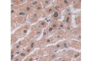 IHC-P analysis of Human Tissue, with DAB staining. (CCL1 antibody  (AA 24-96))